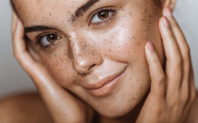 Diagnostic de peau : pourquoi et comment le faire ?